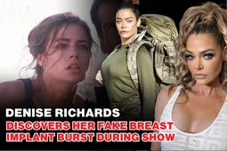 Denise Richards' Shocking On-Set Injury: "007" Star Suffers Breast Implant Rupture